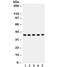 Snail2 antibody, R31818, NSJ Bioreagents, Western Blot image 