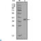 Fatty Acid Binding Protein 4 antibody, LS-C812387, Lifespan Biosciences, Western Blot image 