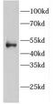 Eukaryotic Translation Initiation Factor 2B Subunit Gamma antibody, FNab02695, FineTest, Western Blot image 