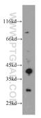 Abhydrolase Domain Containing 12B antibody, 20623-1-AP, Proteintech Group, Western Blot image 