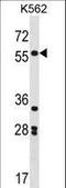 SRY-Box 11 antibody, LS-C161398, Lifespan Biosciences, Western Blot image 