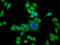 Actinin Alpha 3 (Gene/Pseudogene) antibody, LS-C680117, Lifespan Biosciences, Immunofluorescence image 