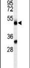 Complement Factor Properdin antibody, PA5-26939, Invitrogen Antibodies, Western Blot image 