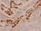 Interferon Gamma Receptor 1 antibody, A01716, Boster Biological Technology, Immunohistochemistry paraffin image 