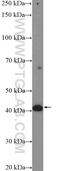 Glutaryl-CoA Dehydrogenase antibody, 14930-1-AP, Proteintech Group, Western Blot image 