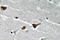 Serpin Family E Member 1 antibody, LS-C177565, Lifespan Biosciences, Immunohistochemistry frozen image 