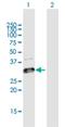 Glycosyltransferase 1 Domain Containing 1 antibody, H00144423-B01P, Novus Biologicals, Western Blot image 