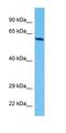 Zinc Finger Protein 614 antibody, orb324580, Biorbyt, Western Blot image 