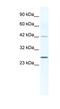 Gap Junction Protein Beta 4 antibody, NBP1-70506, Novus Biologicals, Western Blot image 