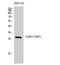 BCL2 antibody, A00040S87, Boster Biological Technology, Western Blot image 