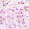 Myocyte Enhancer Factor 2A antibody, LS-C354034, Lifespan Biosciences, Immunohistochemistry frozen image 