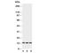 Homeobox A1 antibody, R30836, NSJ Bioreagents, Western Blot image 