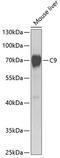 Complement C9 antibody, GTX33054, GeneTex, Western Blot image 