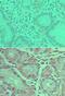 Phospholipase D2 antibody, PA5-23335, Invitrogen Antibodies, Immunohistochemistry paraffin image 