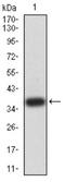 Autophagy Related 2A antibody, NBP2-61689, Novus Biologicals, Western Blot image 