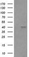 Fc Fragment Of IgG Receptor Ia antibody, LS-C788152, Lifespan Biosciences, Western Blot image 