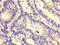Zinc Finger Protein 844 antibody, A64044-100, Epigentek, Immunohistochemistry paraffin image 