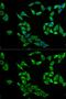 Pleckstrin Homology Like Domain Family A Member 2 antibody, GTX54573, GeneTex, Immunofluorescence image 