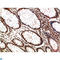 ATM Serine/Threonine Kinase antibody, LS-C813195, Lifespan Biosciences, Immunohistochemistry paraffin image 