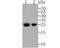 Orosomucoid 1 antibody, NBP2-76901, Novus Biologicals, Western Blot image 