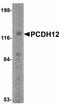 Protocadherin 12 antibody, LS-B4995, Lifespan Biosciences, Western Blot image 