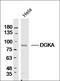 Diacylglycerol Lipase Beta antibody, orb182976, Biorbyt, Western Blot image 