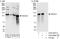 Histone Deacetylase 4 antibody, A303-467A, Bethyl Labs, Immunoprecipitation image 