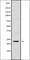 RAB24, Member RAS Oncogene Family antibody, orb338618, Biorbyt, Western Blot image 