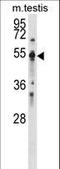 Protein Tyrosine Phosphatase Non-Receptor Type 1 antibody, LS-C155888, Lifespan Biosciences, Western Blot image 