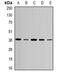 Aurora Kinase C antibody, orb341394, Biorbyt, Western Blot image 