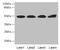 Tubulin Folding Cofactor E Like antibody, LS-C371513, Lifespan Biosciences, Western Blot image 