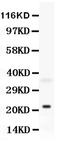 BH3 Interacting Domain Death Agonist antibody, LS-C313503, Lifespan Biosciences, Western Blot image 