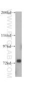 Ubiquitin Specific Peptidase 53 antibody, 16255-1-AP, Proteintech Group, Western Blot image 