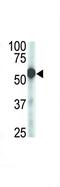 Zinc Metallopeptidase STE24 antibody, PA5-12160, Invitrogen Antibodies, Western Blot image 