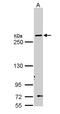 FAS antibody, LS-C186153, Lifespan Biosciences, Western Blot image 