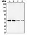 Regulator Of Chromosome Condensation 2 antibody, LS-C353491, Lifespan Biosciences, Western Blot image 