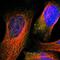 Glucokinase antibody, NBP1-81742, Novus Biologicals, Immunofluorescence image 