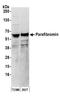 Cell Division Cycle 73 antibody, A300-170A, Bethyl Labs, Western Blot image 