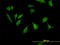 Ribosomal Protein S6 Kinase B1 antibody, LS-B6145, Lifespan Biosciences, Immunofluorescence image 