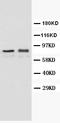 Transferrin Receptor antibody, PA1023, Boster Biological Technology, Western Blot image 