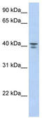 G Protein Subunit Alpha 12 antibody, TA334418, Origene, Western Blot image 