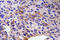 Semaphorin 3A antibody, LS-C199998, Lifespan Biosciences, Immunohistochemistry paraffin image 