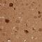 Protein LOC644249 antibody, HPA046346, Atlas Antibodies, Immunohistochemistry paraffin image 