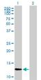 Zinc Finger Protein 343 antibody, H00079175-B01P, Novus Biologicals, Western Blot image 