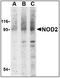 Nucleotide Binding Oligomerization Domain Containing 2 antibody, AP08943PU-N, Origene, Western Blot image 