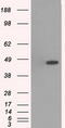 Mitogen-Activated Protein Kinase 12 antibody, M03942, Boster Biological Technology, Western Blot image 