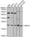 Transmembrane P24 Trafficking Protein 10 antibody, GTX33548, GeneTex, Western Blot image 