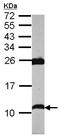 Phospholamban antibody, ab126174, Abcam, Western Blot image 