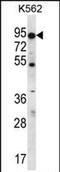 ATP Binding Cassette Subfamily D Member 2 antibody, PA5-71733, Invitrogen Antibodies, Western Blot image 