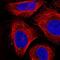 Semaphorin 3A antibody, NBP2-56804, Novus Biologicals, Immunofluorescence image 